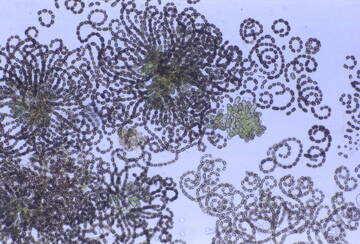 Image: 1-Dolichospermum