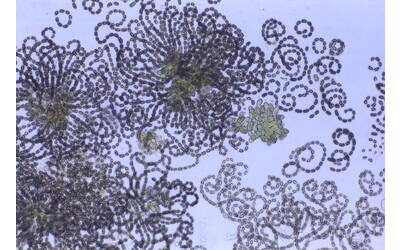 Image: 1-Dolichospermum