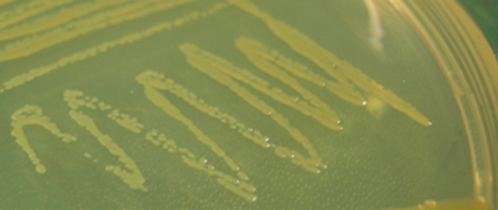 Image: Immagine Lysobacter - Claudio Moser